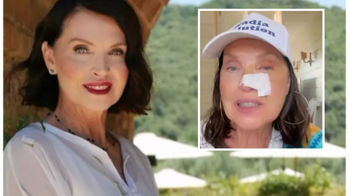 Nadia Mayer, Star di 'Casa a Prima Vista': Operata per Tumore alla Pelle e Lancia Appello alla Prevenzione